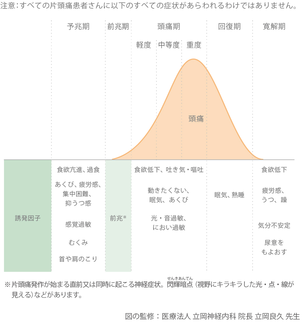 片頭痛の症状の経過の図版